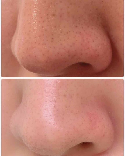 カネボウ ソフニング クリーム クレンジング/KANEBO/クレンジングクリームを使ったクチコミ(2枚目)