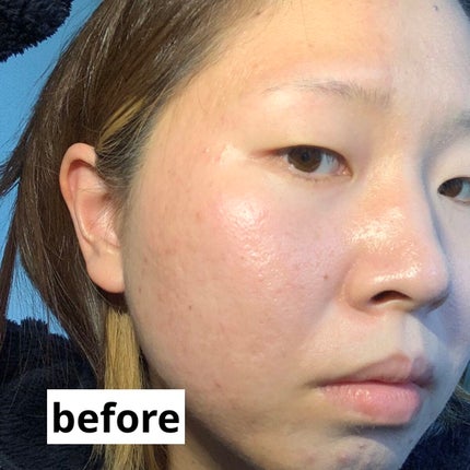 ミネラル 薬用プレストパウダー/TIME SECRET/プレストパウダーを使ったクチコミ(5枚目)