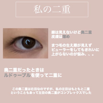 ワンダーアイリッドテープ Extra/D-UP/二重まぶた用アイテムを使ったクチコミ(2枚目)