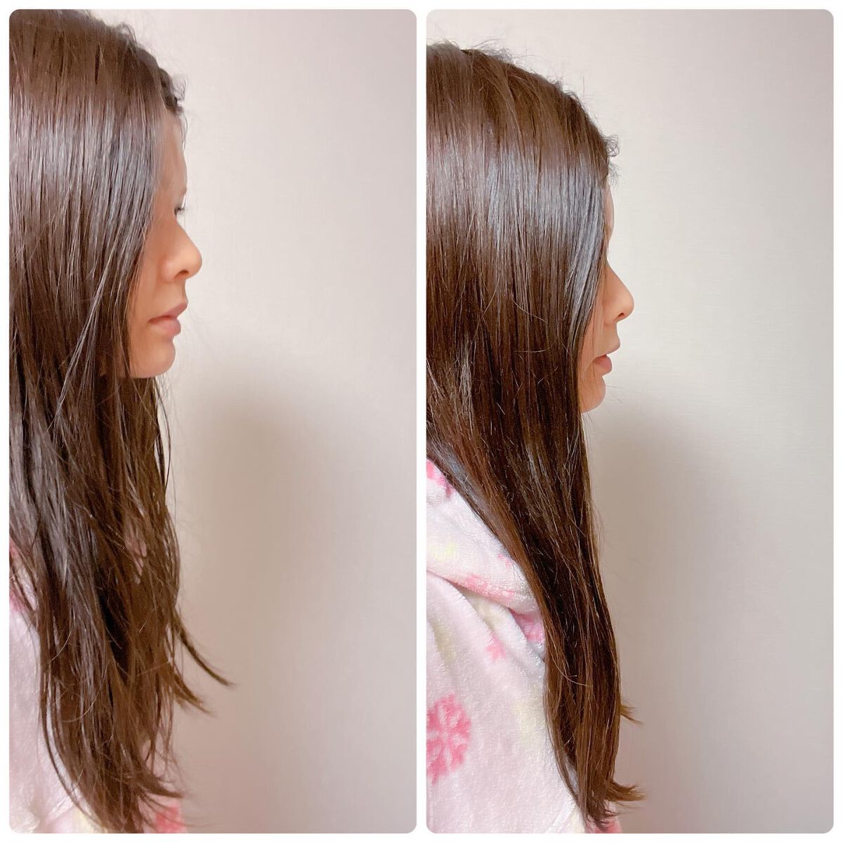 トリートメントセット/BIMERA/その他キットセットを使ったクチコミ（2枚目）