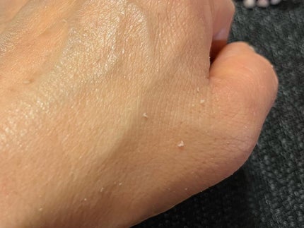 美白乃美人ピーリングジェル/ブレーンコスモス/ピーリングを使ったクチコミ(4枚目)