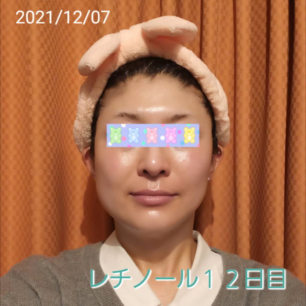 モイスチャーバーム ジャー/キュレル/フェイスクリームを使ったクチコミ（1枚目）