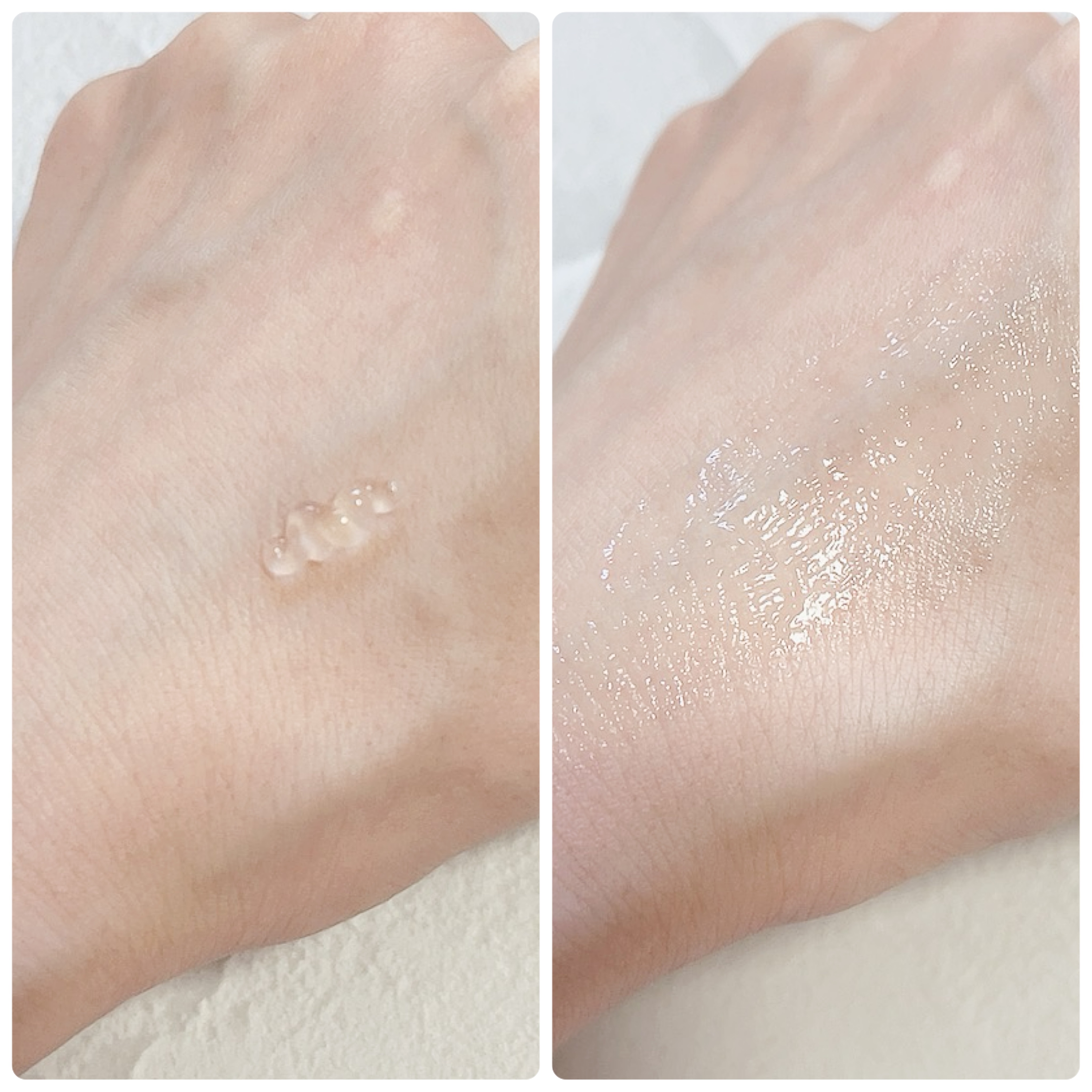 PEPTIDE VOLUME BOTUL-PEP WRINKLE AMPOULE /DR.PEPTI/美容液を使ったクチコミ（3枚目）