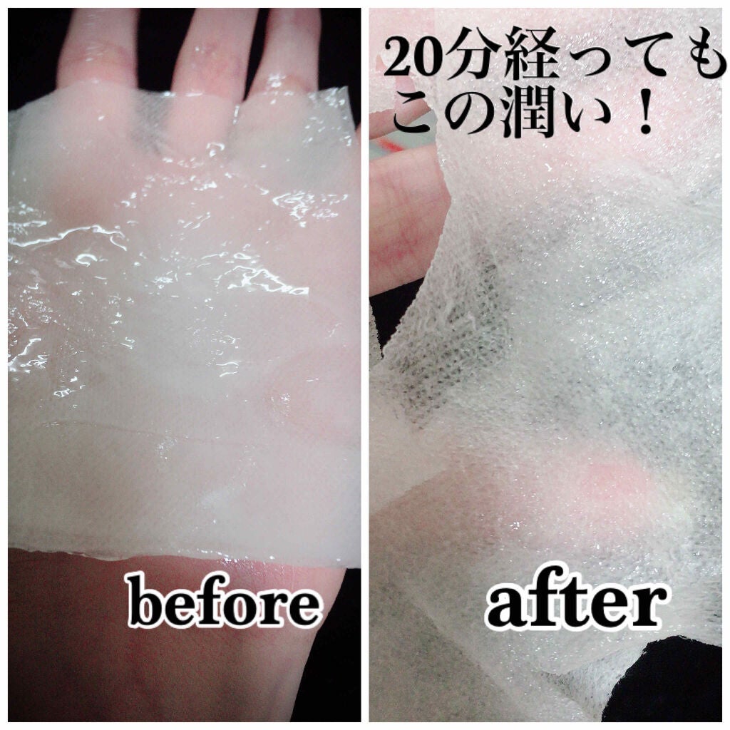 アクアアドバンストフェイシャルマスク /Leaders Clinie(リーダーズ)/シートマスク・パックを使ったクチコミ(3枚目)