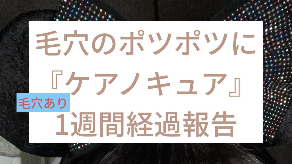 ケアノキュア（医薬品）/小林製薬/その他を使ったクチコミ（1枚目）