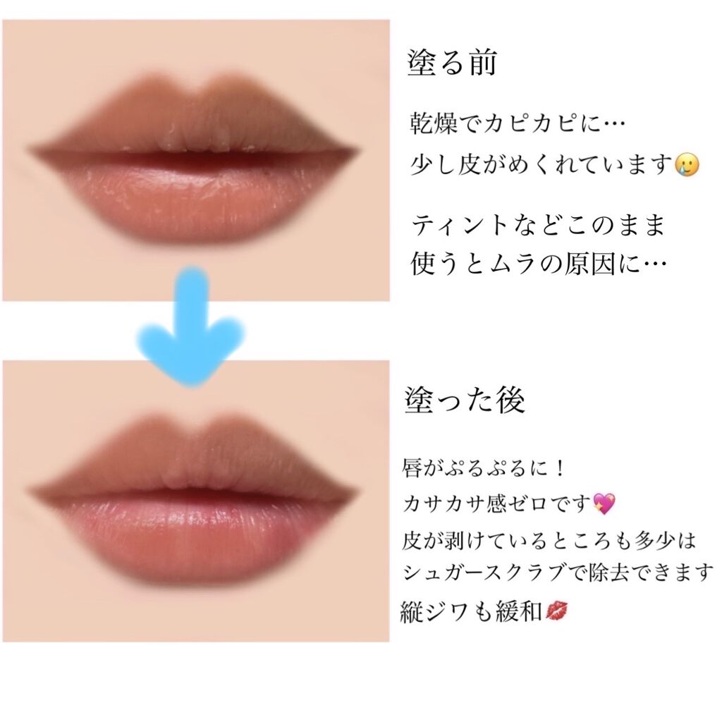 薬用リップスティックXD/メンソレータム/リップクリームを使ったクチコミ（3枚目）