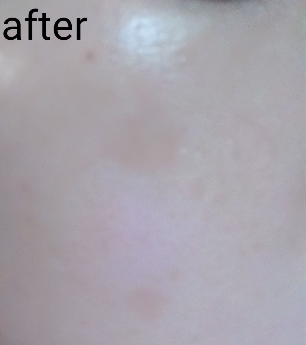 グリーンタンジェリン ビタC ダークスポットケアセラム/goodal/美容液を使ったクチコミ(3枚目)