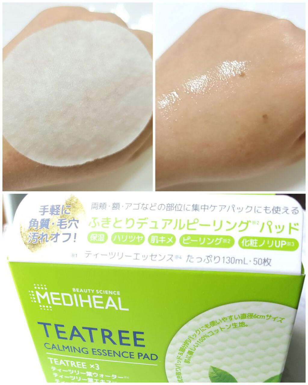 A-zero Shot Trouble Dressing Spot Patch/MEDIHEAL/シートマスク・パックを使ったクチコミ（3枚目）