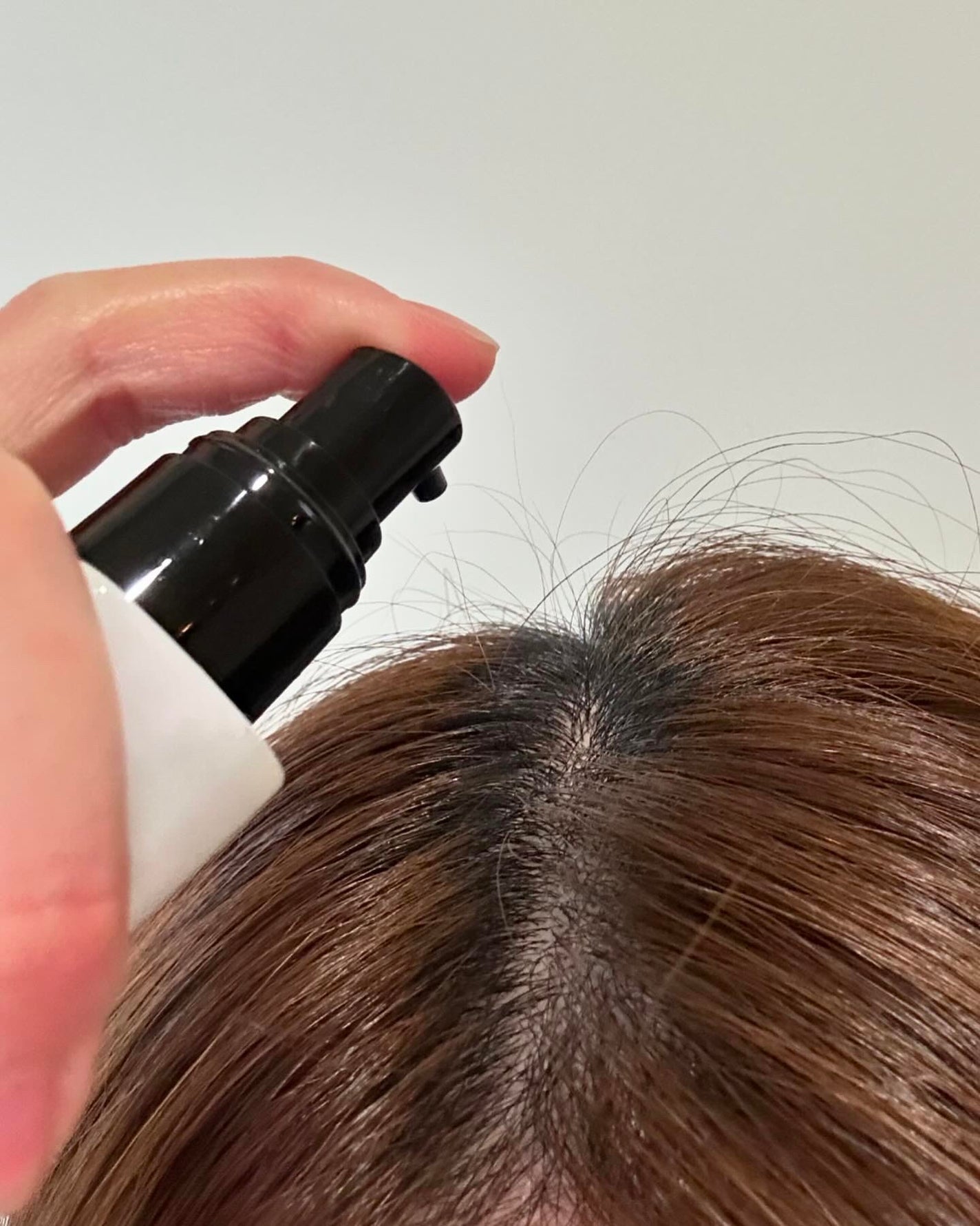 チャップアップ育毛ローション/CHAP UP(チャップアップ)/頭皮ローションを使ったクチコミ(3枚目)