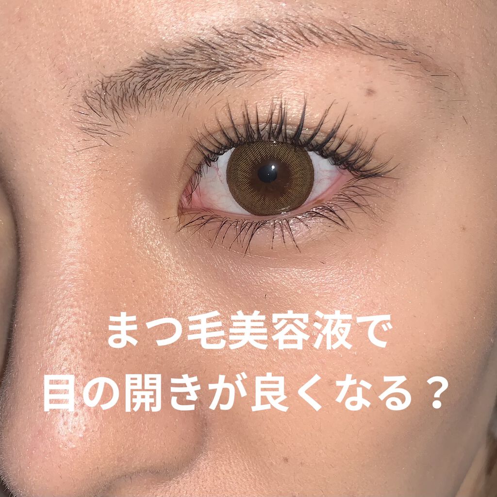 スキンローション/ポタニーニ/ミスト状化粧水を使ったクチコミ（1枚目）