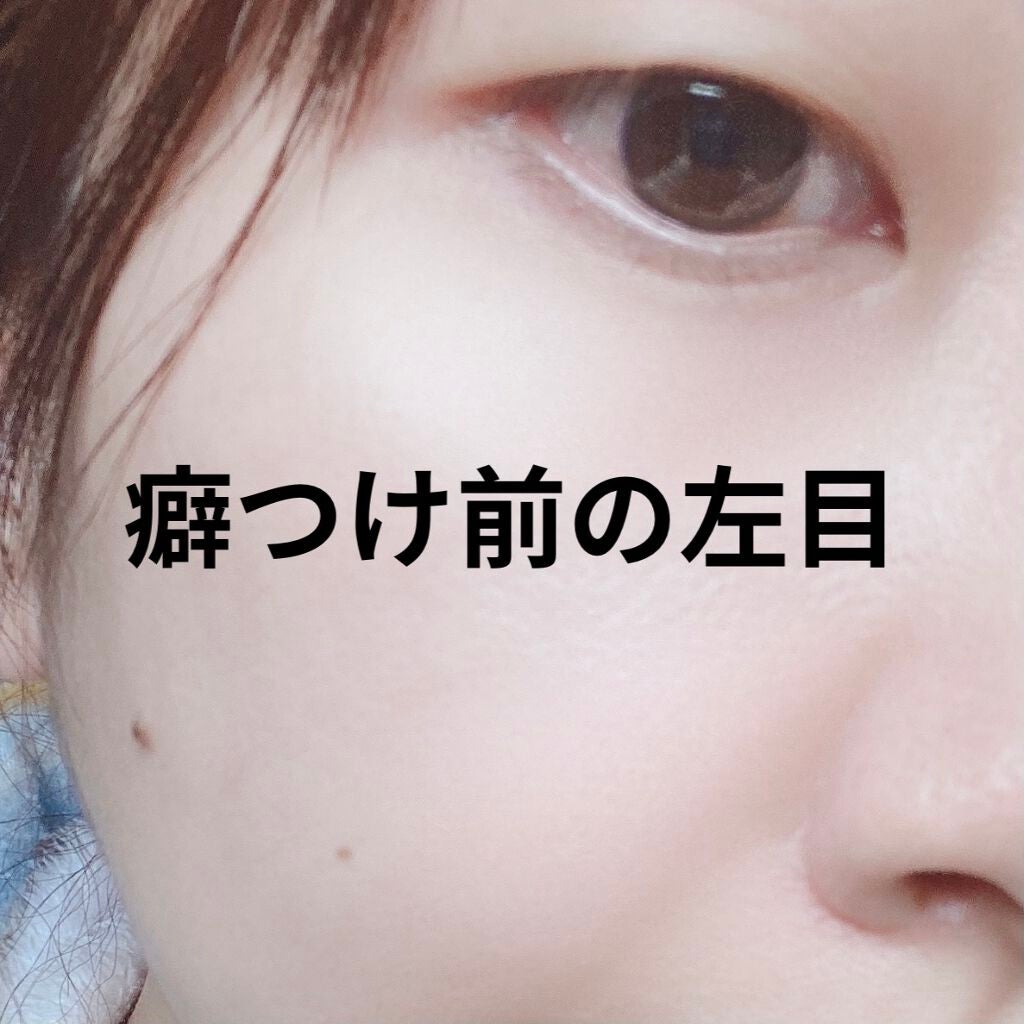 ERN on LIPS 「こんにちは〜💭今回は先日から遂に二重の癖つけを始めたのでその際..」(2枚目)