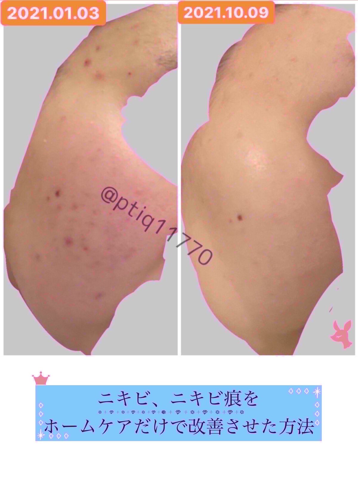 ザ・タイムR アクア/IPSA/化粧水を使ったクチコミ（1枚目）