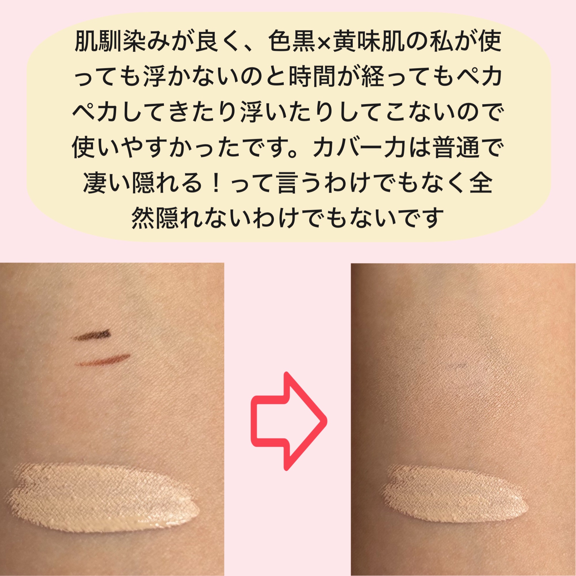 エクストラ スキニー コンシーラー 02 ライトピンクベージュ/Visée/リキッドコンシーラーを使ったクチコミ（3枚目）