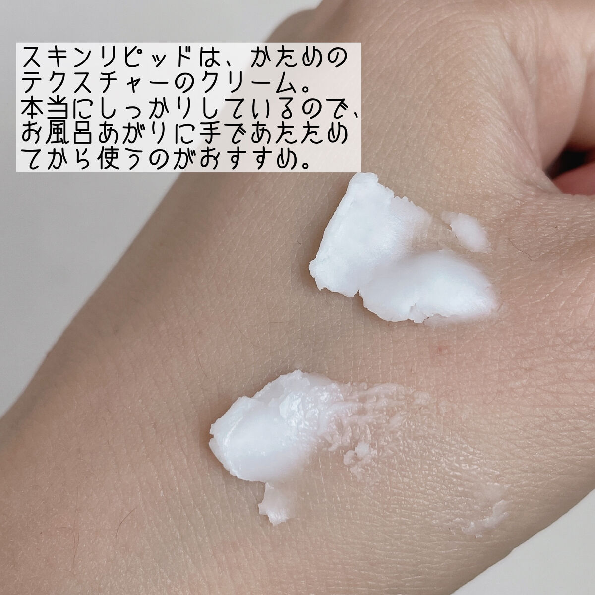 メディコル トライアルセット/ナノエッグ/スキンケアキットを使ったクチコミ（3枚目）