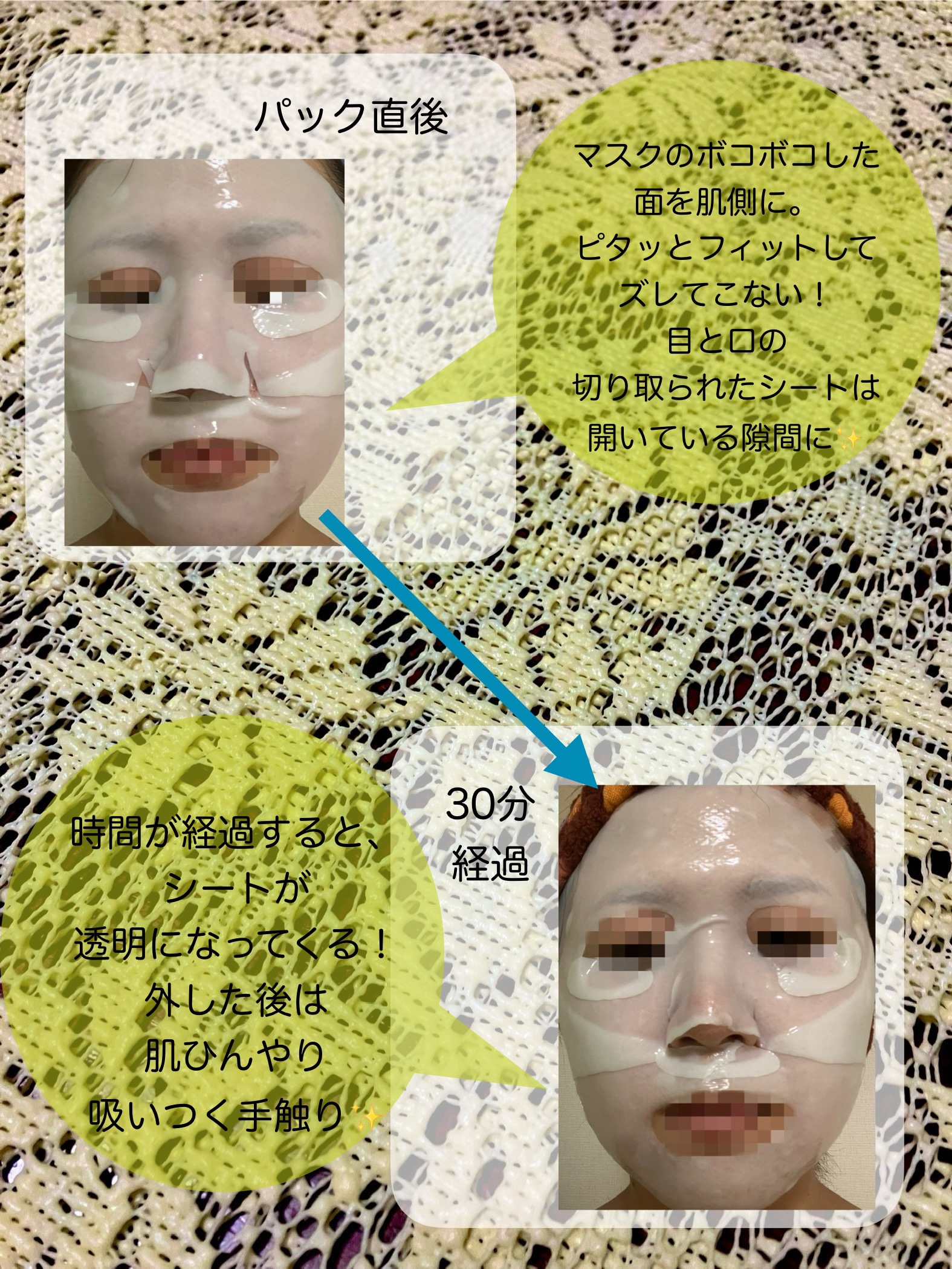 パーフェクト リアル パフォーマンス シカコラーゲンマスクパック /ダーマフィックス/シートマスク・パックを使ったクチコミ（3枚目）