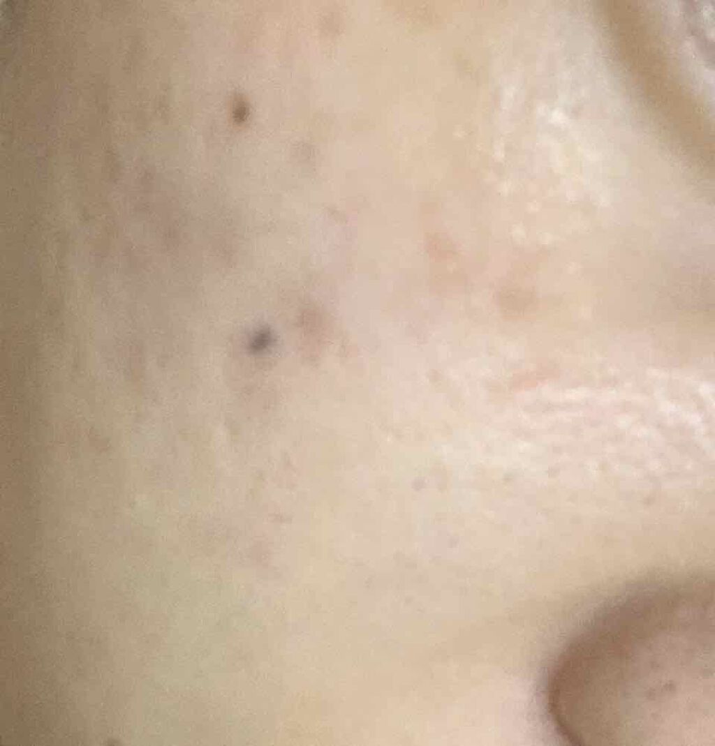 フレッシュリージュースドビタミンドロップ(35ml)/Klairs/美容液を使ったクチコミ(3枚目)