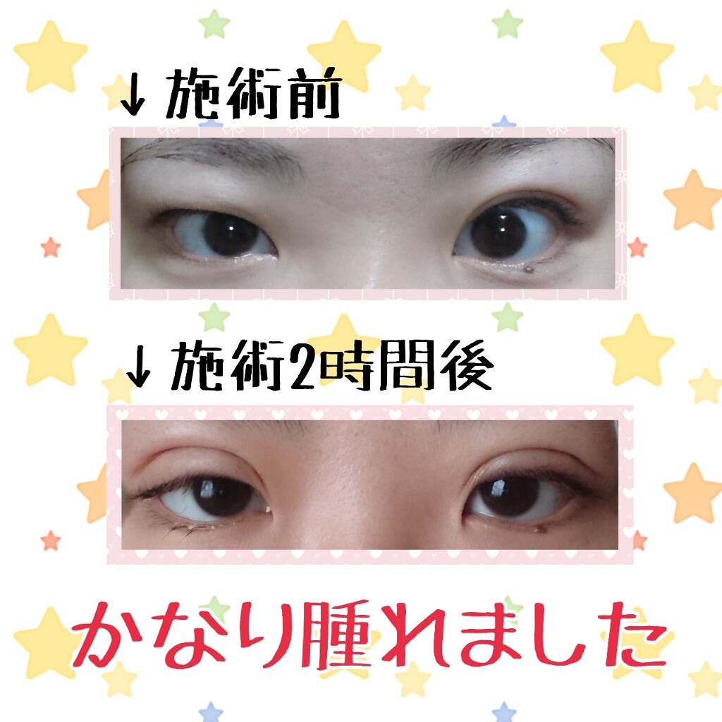 kyareeen(^-^) on LIPS ãðæŽåœ¢ã¬ãðããã«ã¡ã¯ïŒããã°ãã¯ïŒæ°ãã€ããããã©ãã¯ãŒæ§3..ãïŒ2æç®ïŒ