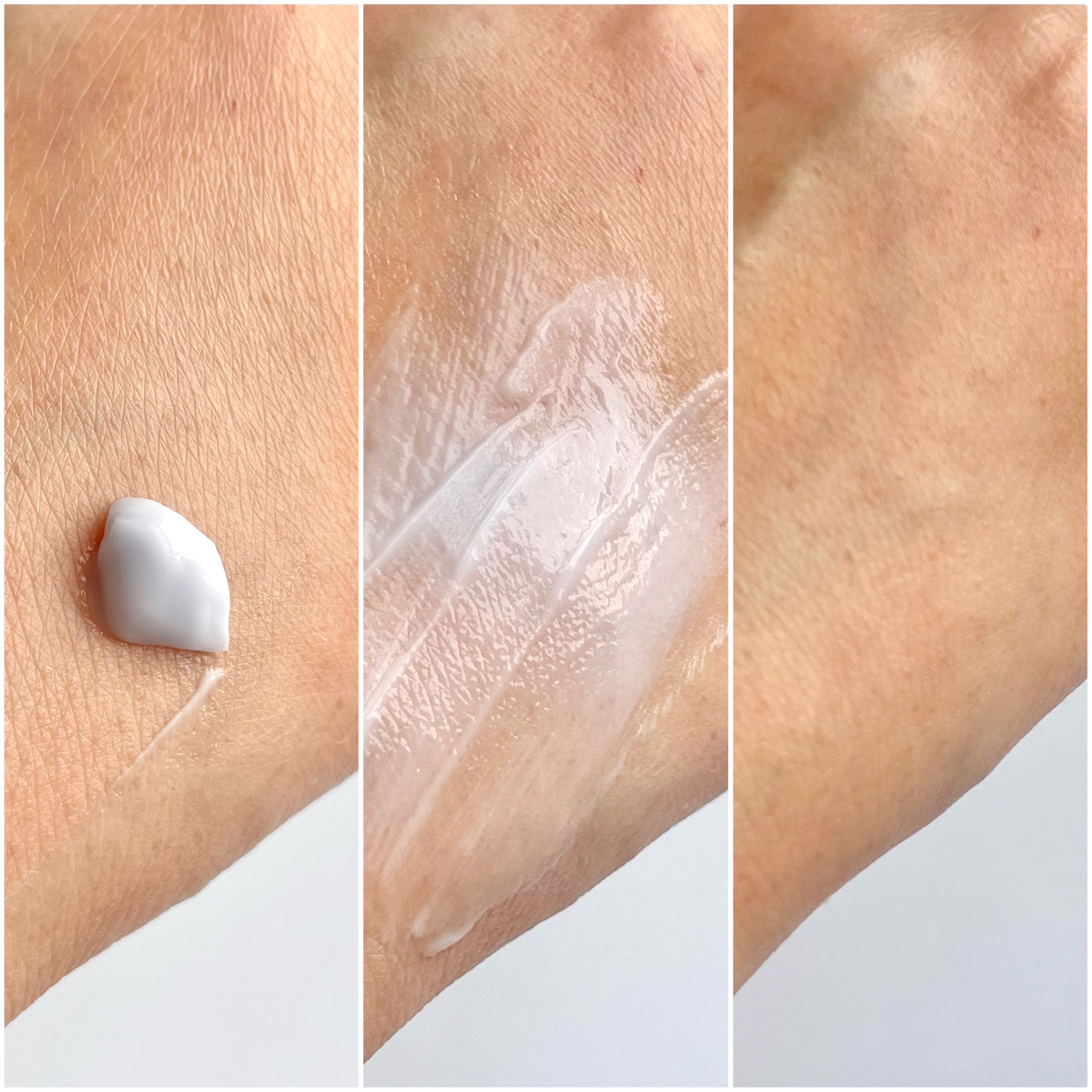 ハイポアレジェニック シカ クリーム/Dermatory/フェイスクリームを使ったクチコミ（2枚目）