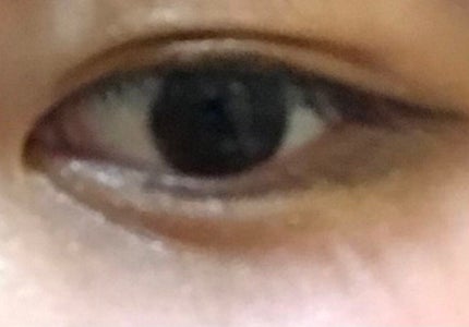 のびーるアイテープ(絆創膏タイプ、レギュラー)/DAISO/二重まぶた用アイテムを使ったクチコミ(1枚目)