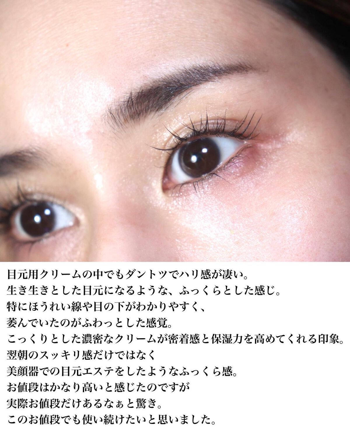 アイゾーンクリーム/B.A/アイケア・アイクリームを使ったクチコミ(4枚目)