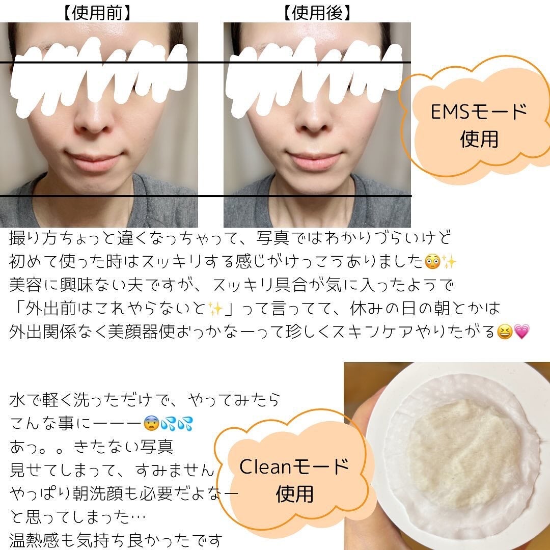 多機能温冷美顔器/ANLAN/美顔器・マッサージを使ったクチコミ(7枚目)