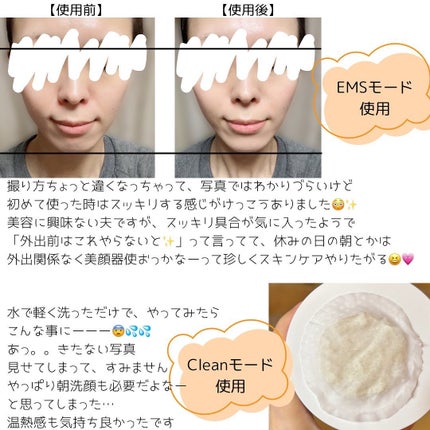 多機能温冷美顔器/ANLAN/美顔器・マッサージを使ったクチコミ(7枚目)