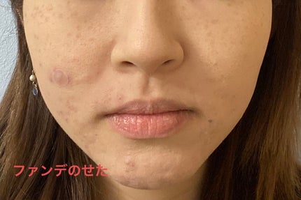 スターターキット(マット) #20/エトヴォス/トライアルキットの画像