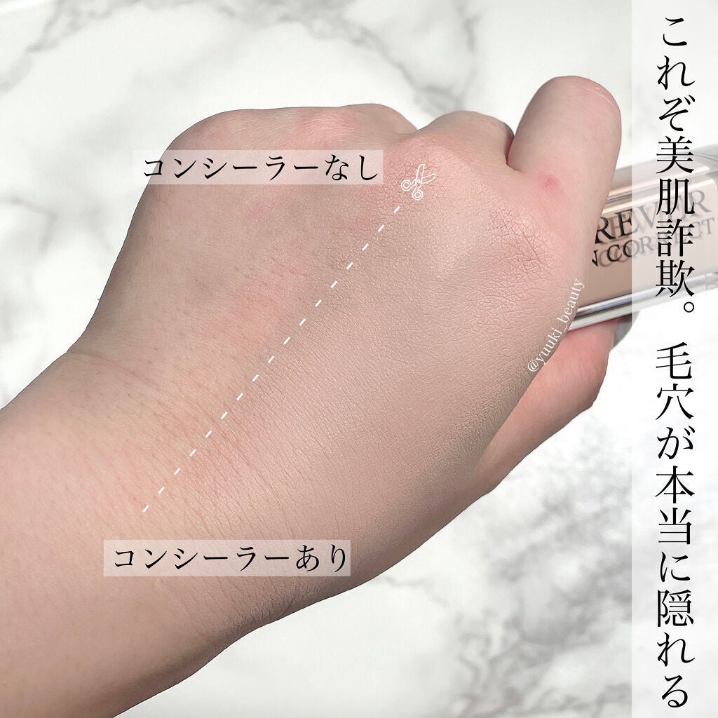 【旧】ディオールスキン フォーエヴァー スキン コレクト コンシーラー/Dior/リキッドコンシーラーを使ったクチコミ(4枚目)