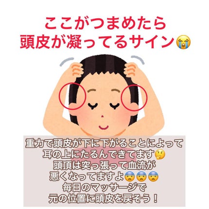 tsukasa✂︎ on LIPS 「。あなたの頭皮は大丈夫ですか?。セルフチェックして、今の状態を..」(4枚目)
