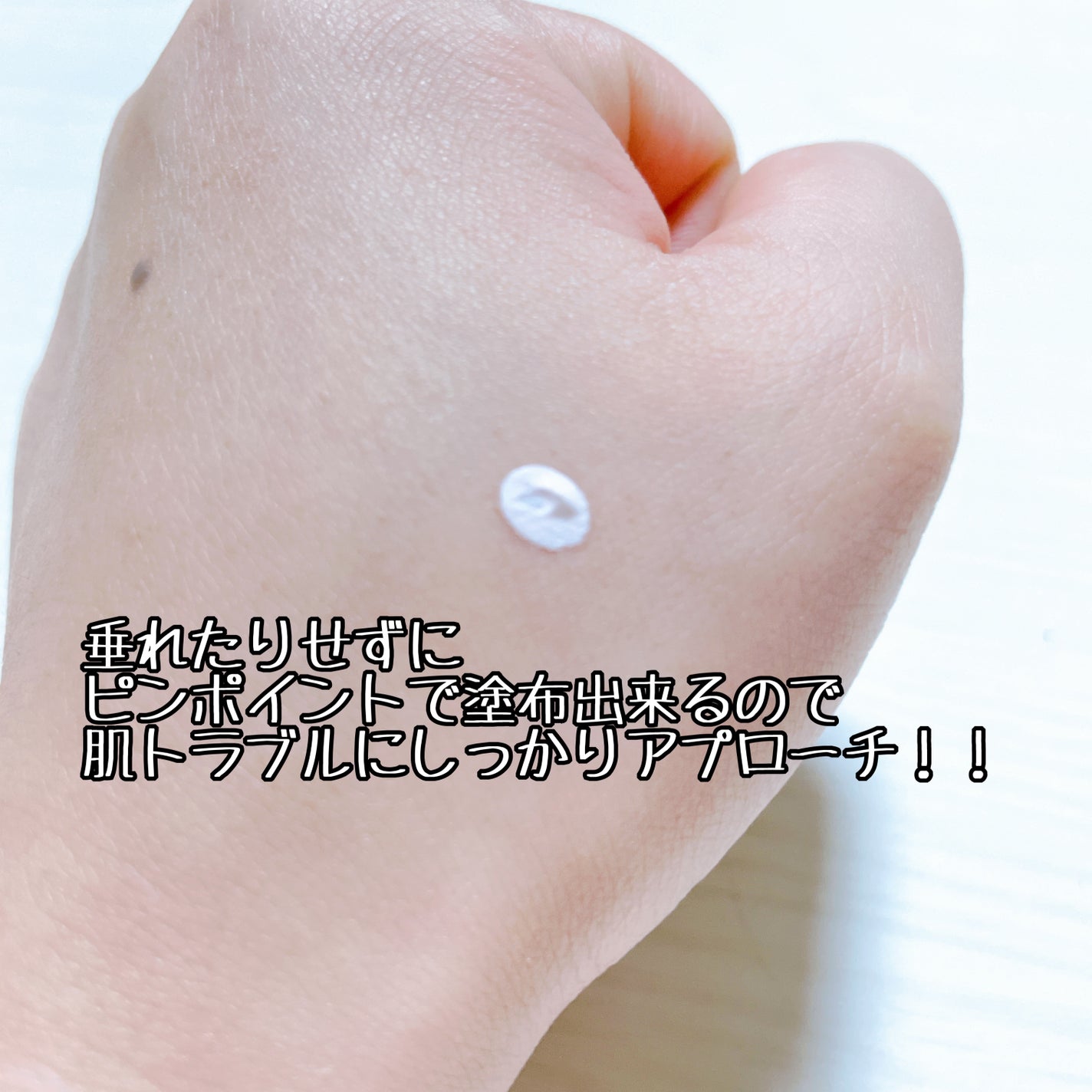 ピンクパウダースポットトリートメント/EUYIRA/その他スキンケアを使ったクチコミ(4枚目)