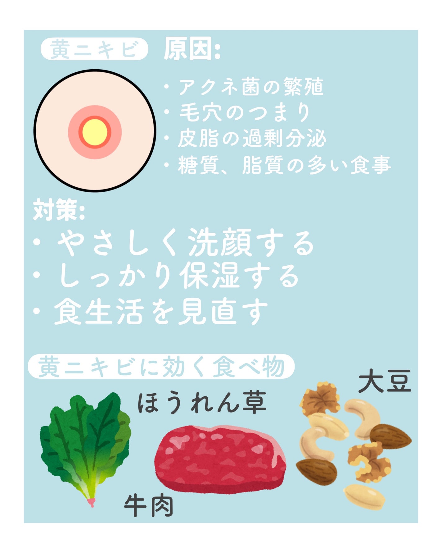 ハトムギ化粧水(ナチュリエ スキンコンディショナー R )/ナチュリエ/化粧水を使ったクチコミ(5枚目)