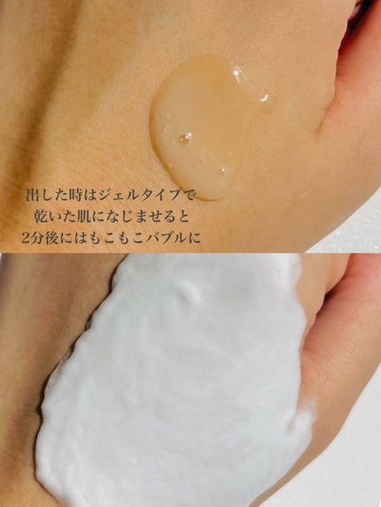 ドクダミオートバブルウォッシュオフマスクパック/be the skin/洗い流すパック・マスクを使ったクチコミ(4枚目)