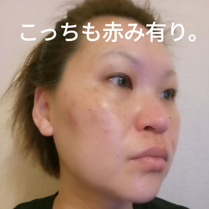 クリアケア化粧水/無印良品/化粧水を使ったクチコミ(4枚目)