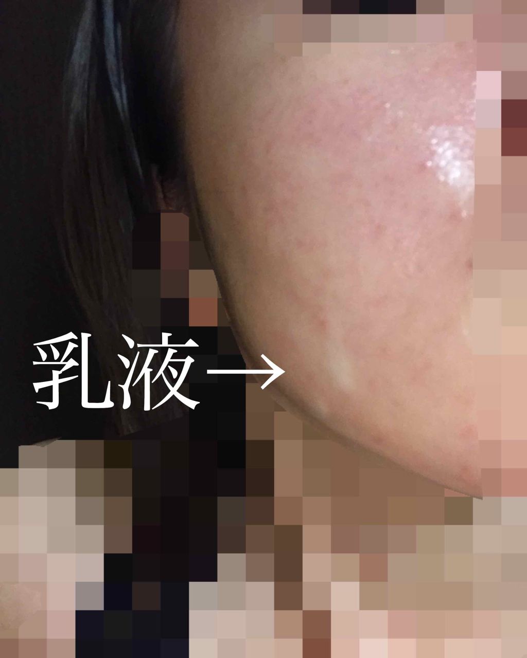 ベルブラン/あいび/美容液を使ったクチコミ（3枚目）