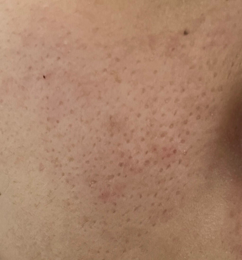 ããð on LIPS ãããã«ã¡ã¯ä»ãèã®éãæ¯ç©Žã§ãšãŠãæ©ãã§ããŸãã¡ã©ãCCããªã¬..ãïŒ4æç®ïŒ