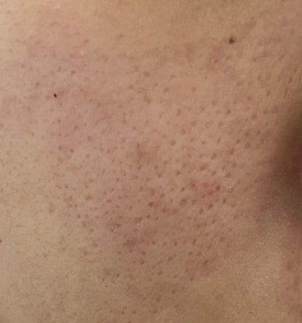 ããð on LIPS ãããã«ã¡ã¯ä»ãèã®éãæ¯ç©Žã§ãšãŠãæ©ãã§ããŸãã¡ã©ãCCããªã¬..ãïŒ4æç®ïŒ