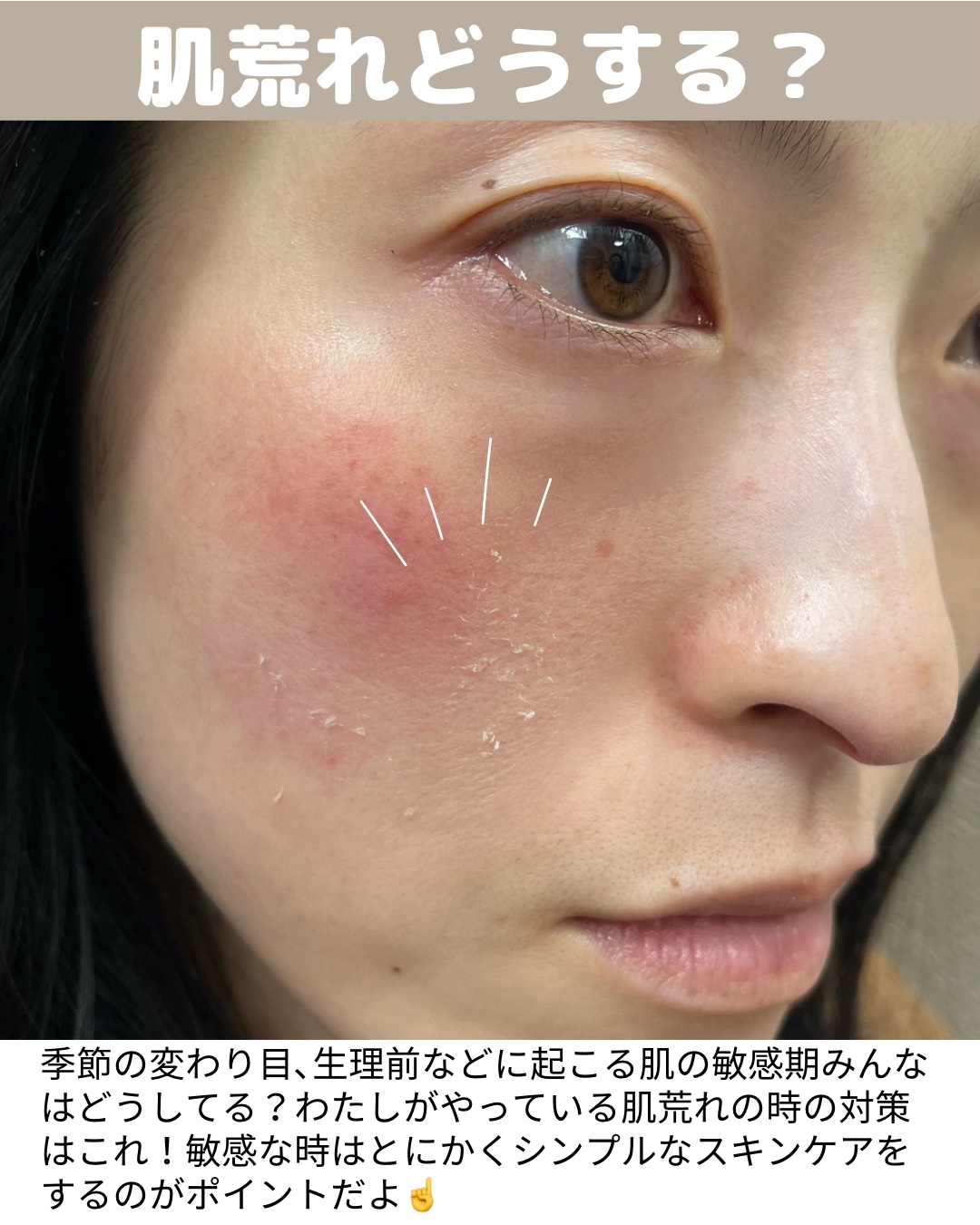 ウィートスプラウトウォーターカーミングパッド/VELY VELY/トナーパッドを使ったクチコミ（2枚目）