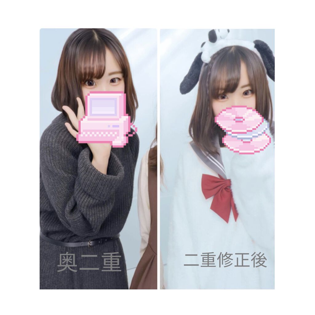 24h FUTAE/inglewood Beauty/二重まぶた用アイテムを使ったクチコミ（2枚目）