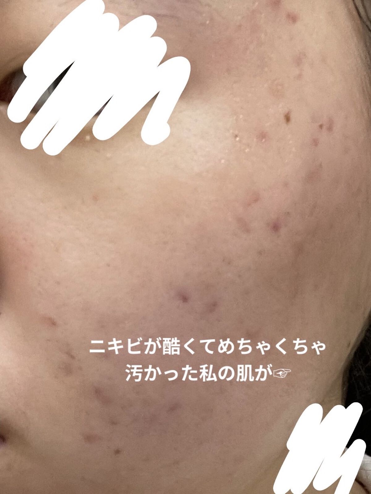 明色美顔水 薬用化粧水/美顔/化粧水を使ったクチコミ（2枚目）