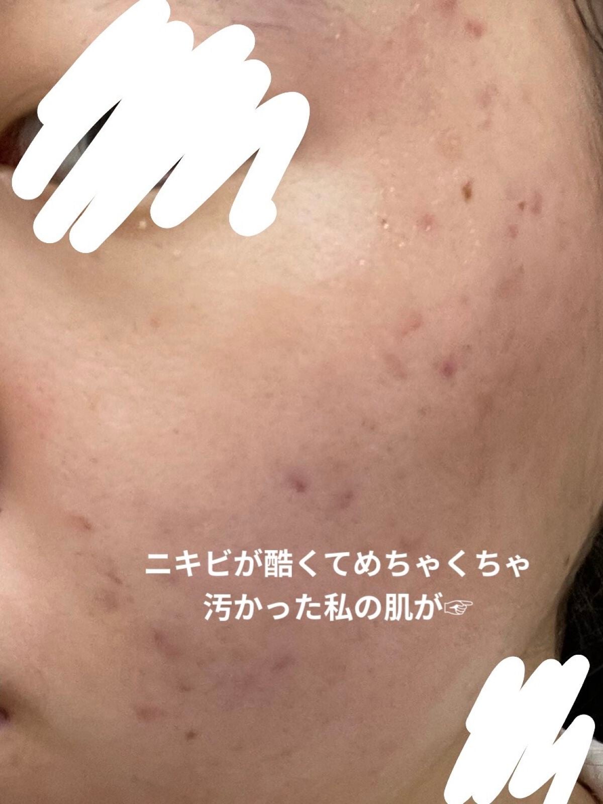 明色美顔水 薬用化粧水/美顔/化粧水を使ったクチコミ(2枚目)