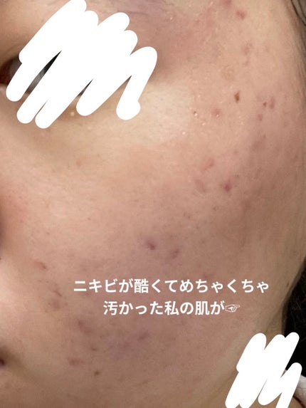 明色美顔水 薬用化粧水/美顔/化粧水を使ったクチコミ(2枚目)