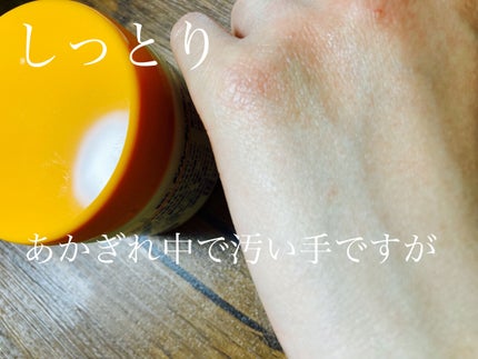 ビタミンクリーム/メンソレータム/ボディクリームを使ったクチコミ(4枚目)