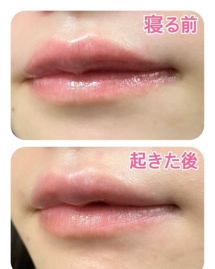 ダーマパワーX リップエッセンス/オバジ/リップ美容液を使ったクチコミ(2枚目)