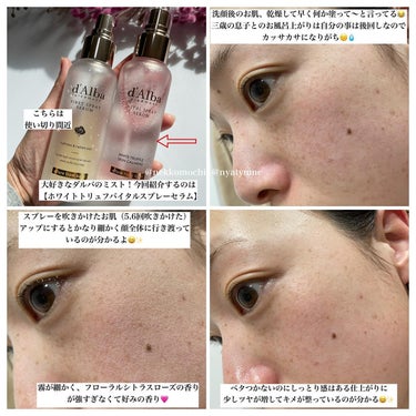 🌷スキンケアレビュー🌷

▶︎ダルバ　VITAL SPRAY SERUM(エッセンショルスプレーセラム)

トナー＋ミスト＋セラム＋エッセンスを1度に噴射！！細かい霧とベタつかないけど保湿してくれて、メイクの上からも使える万能さが大好きです😆✨

お風呂上がりのお肌とバイタルスプレーセラムを吹きかけてなじませた後のお肌は比べるとハ違うと思います（画像レビュー参照）

ツヤは出ますが、手に頬が吸い付いたりはしません
ベタつきはないので、次に使うスキンケアにも悩みません

動画を見ていただくと分かると思うのですが、とても霧が細かくて、沢山ふきかけても顔にちゃんと乗ってる？と言うくらい重くないんです🤔

私はお風呂上がってすぐびしゃびしゃに吹きかけて息子の着替えやらを終わらせてからもう一度吹きかけてなじませています☺️🫶💓

お風呂上がりの乾燥は私にとっては大敵（レビューの時は息子の着替えを終わらせてから吹きかけたので、吹きかけた瞬間生き返りました😂）

以前いただいたファーストスプレーセラムはもうすぐ使い切りそうです🥹

この２つ、使い心地に大きな差はありませんが、香りが違いますね😆✨

バイタルスプレーセラムはフローラル系なので、こちらの方が好みかな？

メイクの上から保湿として使ってもメイクがヨレたりすることもないので、どんな季節でも手にとってしまいますね🌷

https://bit.ly/4bwbrIU

＠dalba_japan

＃PR
＃低刺激セラム
＃生き生きとした肌
＃水分保湿
＃爽やかな仕上がり感
＃ダルバ
＃dalba
＃ダルバミスト
#ヴィーガンミスト
#にゃんこもちの当選レビュー
#当選報告
#スキンケアレビュー
#美容仲間募集の画像 その1