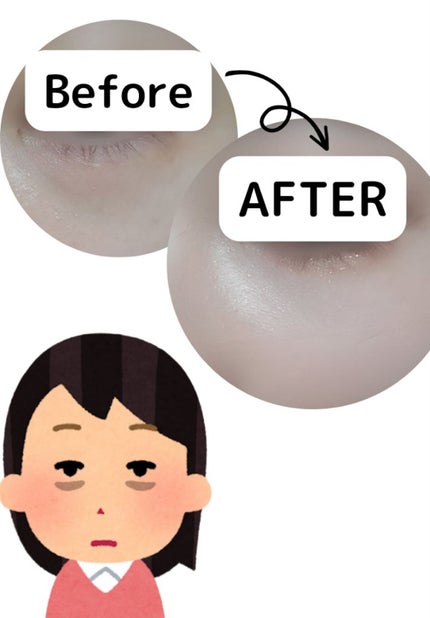 マットラディアンス ベイクドパウダー ハイライト01/ローラ メルシエ/パウダーハイライトを使ったクチコミ(2枚目)