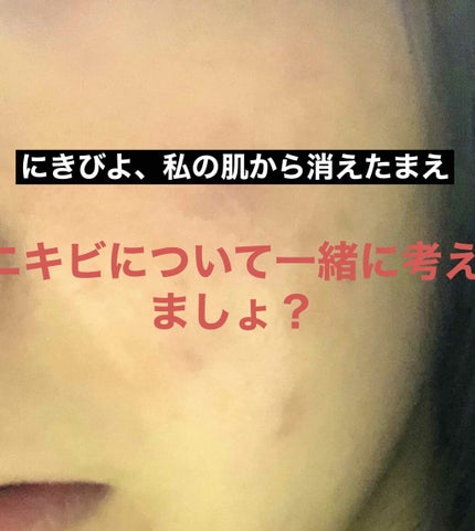 ドクタージャルト シカペア クリーム (第2世代)/Dr.Jart+/フェイスクリームを使ったクチコミ(1枚目)