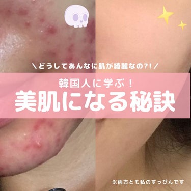 AHA 30% + BHA 2% Peeling Solution/The Ordinary/ピーリングを使ったクチコミ（1枚目）