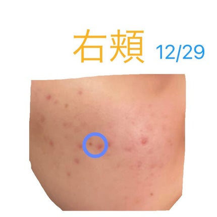 ハトムギ化粧水(ナチュリエ スキンコンディショナー R )/ナチュリエ/化粧水を使ったクチコミ(3枚目)