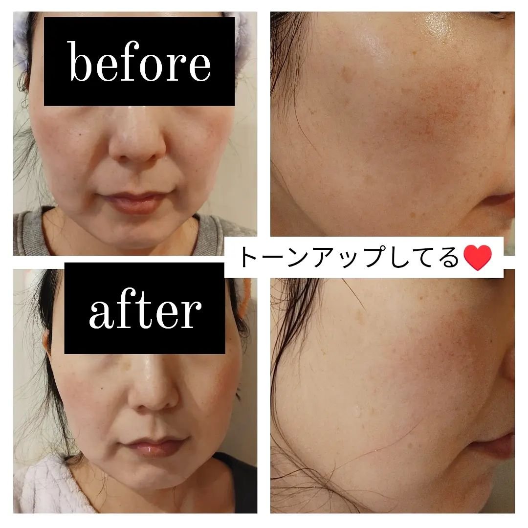 リードルショット ビタライト クリーム/VT/フェイスクリームを使ったクチコミ（2枚目）