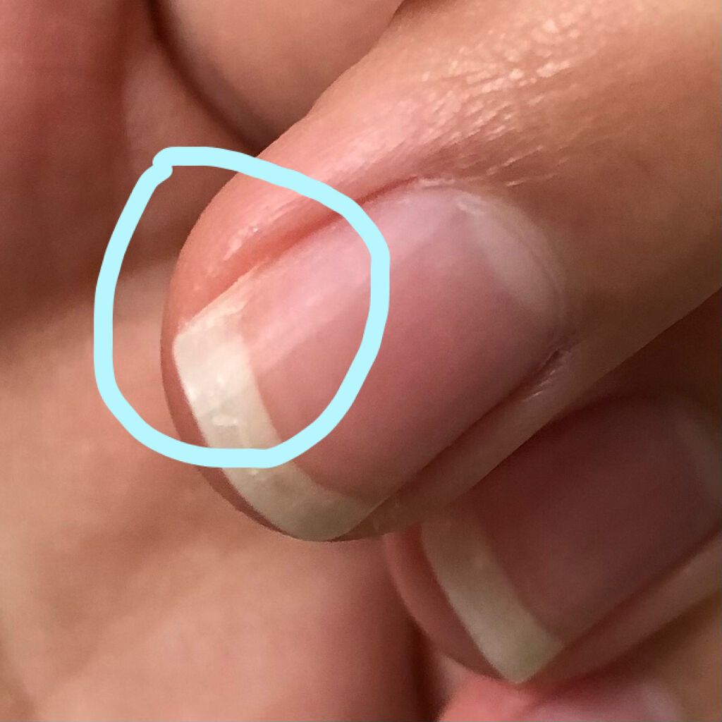 ðåã«ãªããã女ã®å on LIPS ãèŠãŠãããŠããããšãããããŸãðð»çªã®åœ¢ãå
ã
æªããšããããã§..ãïŒ2æç®ïŒ